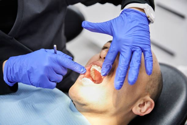 Best Broken or Chipped Tooth Repair in Mcdonald, OH